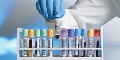 what-does-a-medical-laboratory-assistant-do